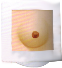 乳腺癌鑒別診斷訓練模型